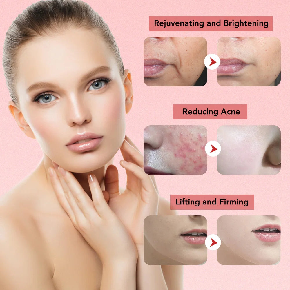 AuraSkin 7-in-1 Face Lifting Machine - Wrinkle Remover